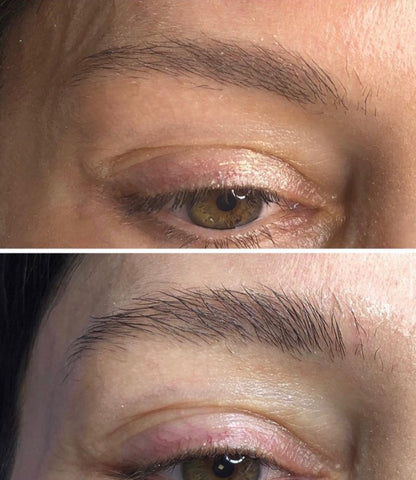 Eyebrow Growth Treatment (Vitamin Brow Service)